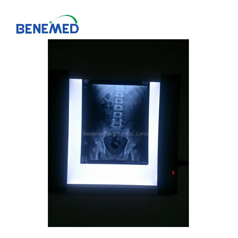 Ultraslim LED X-ray el visor de la película sola Sección BV-360