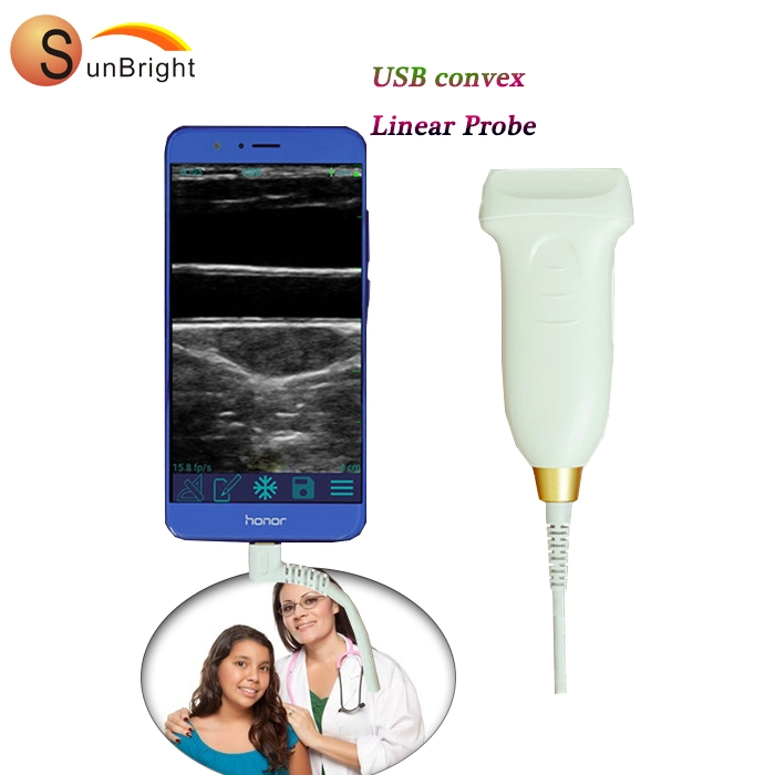 Cheapest USB 2D Portable USB Probe Type Ultrasound Convex Probe Price Wireless Ultrasound