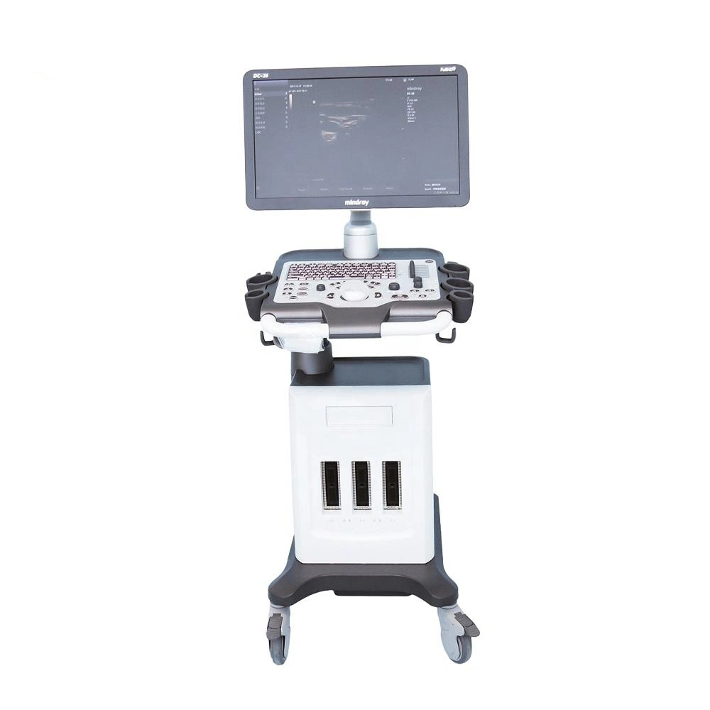 Mindray Color Doppler Ultrasound&Pregnant Ultrasound Scanner Similar