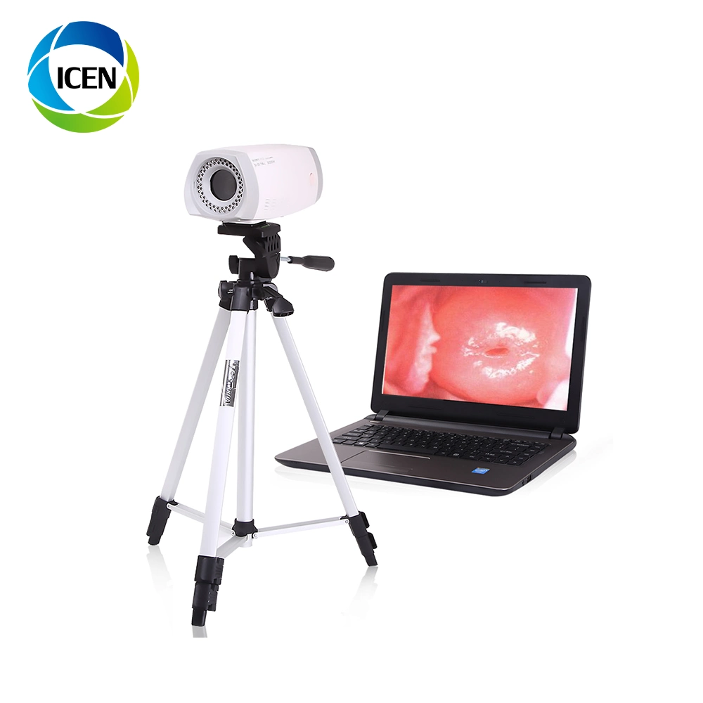 In-G9800 Medical Hospital Digital Video Colposcope for vagin Gynécologie