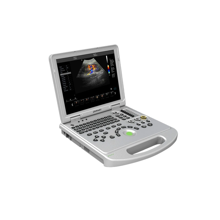 Medical Full-Digital Laptop Ophthalmic Ultrasonic Transducer Ultrasound Scanner Machine with Convex Probe