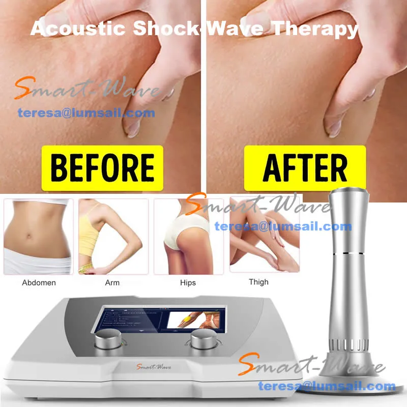 Smartwave BS-SWT2X para la celulitis y el tratamiento muscular