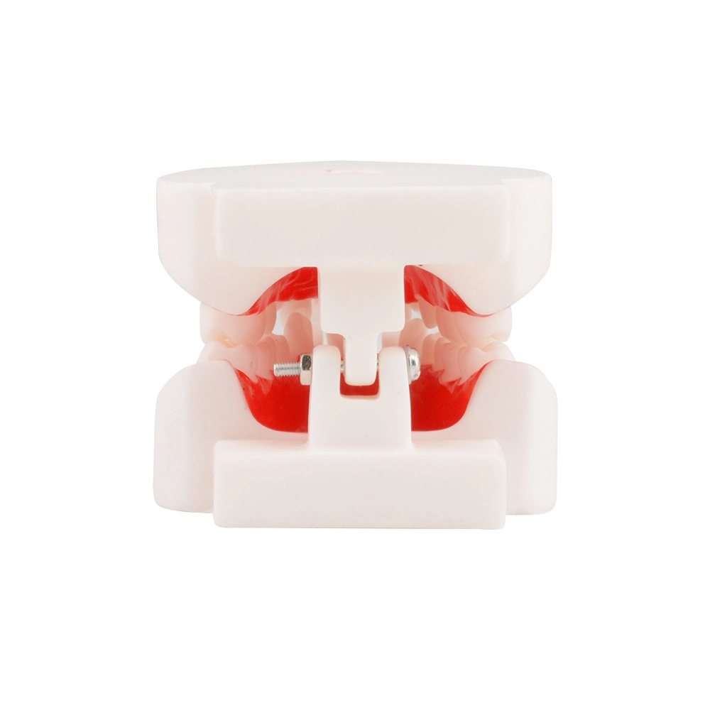 الندبة الانسداد المسن الانسج الأسنان النموذج التشريحي