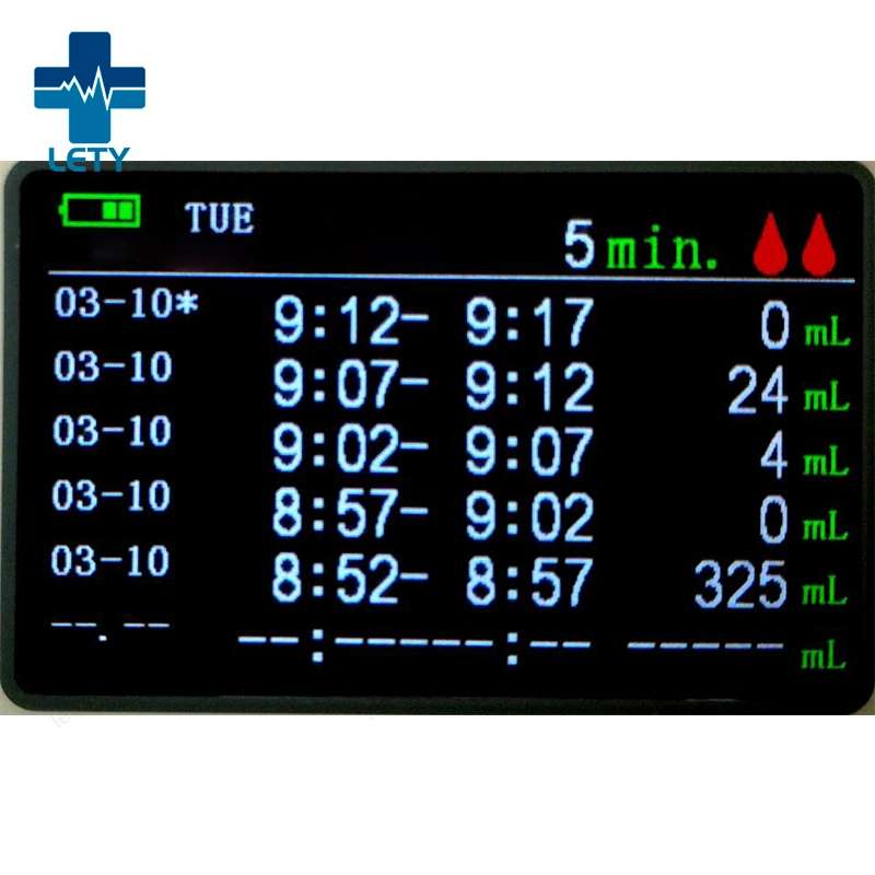 Automated Accurate Real-Time Urine Flow Meter Monitoring Dynamic Urine Meter