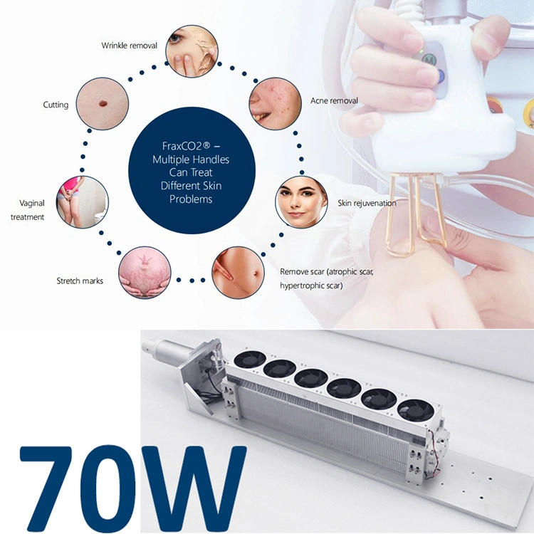 Professional Acne Scar Treatment Laser Treatment CO2 Fractional Stretch Mark Removal Beauty Machine Beauty Salon Equipment