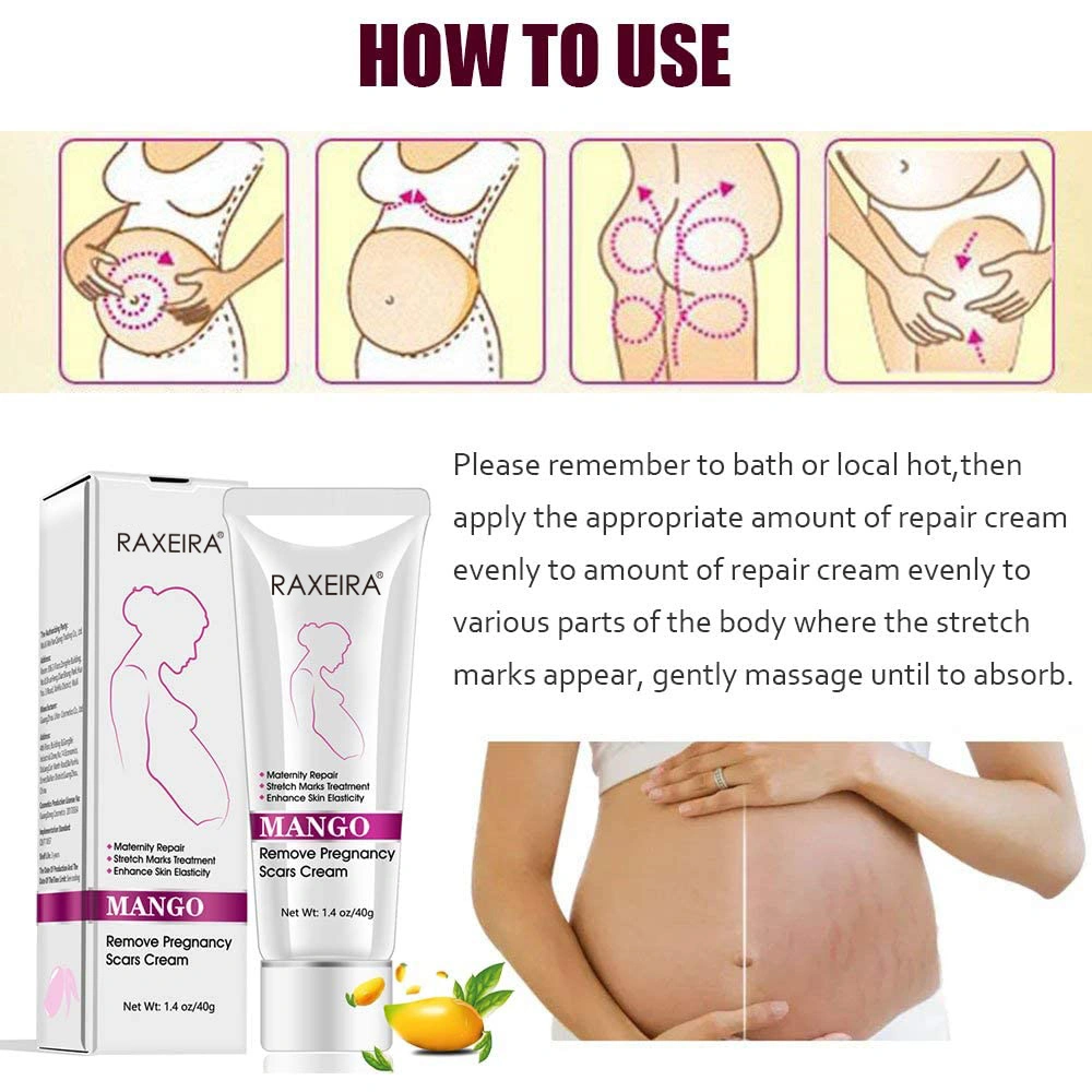 Wholesale/Supplier Scar Post-Natal Repair and Anti-Obesity Growth Lines and Pregnancy Lines Repair Cream