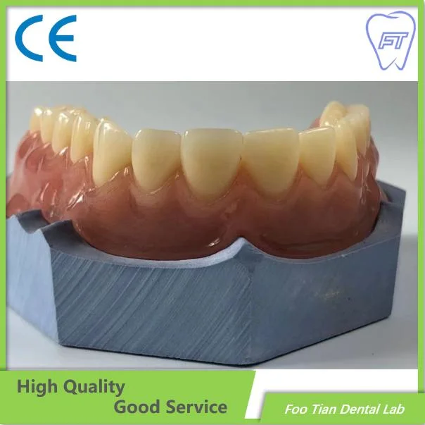 Dentadura extraíble de alta calidad marco parcial de fundición personalizados Dental