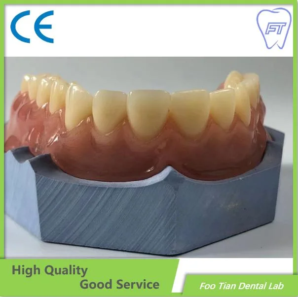 High quality/High cost performance  Removable Denture Cast Partial Framework Dental Customized