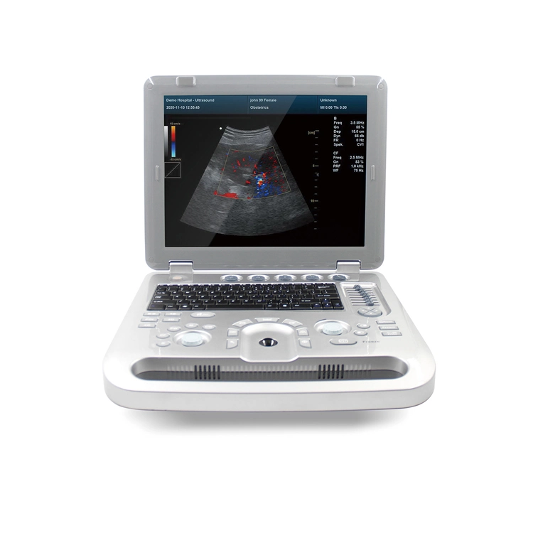 Contec Cms1700b-Vet Veterinary Ultrasound Equipment Dog Pet Ultrasound Machine