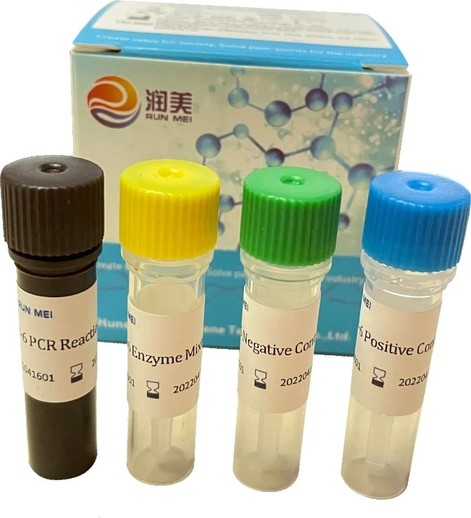 La difteria ToxB bacilo (GEN) Kit de detección de ácido nucleico Pre-Packed método PCR (fluorescencia)