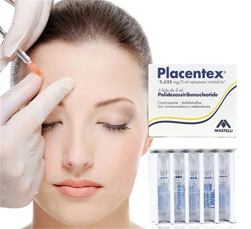 High quality/High cost performance  Placentex Skin Regeneration Pdrn Dermal Fillers Anti Wrinkles Salmon DNA Ingredients Injectable Filler Beauty Skin Filling