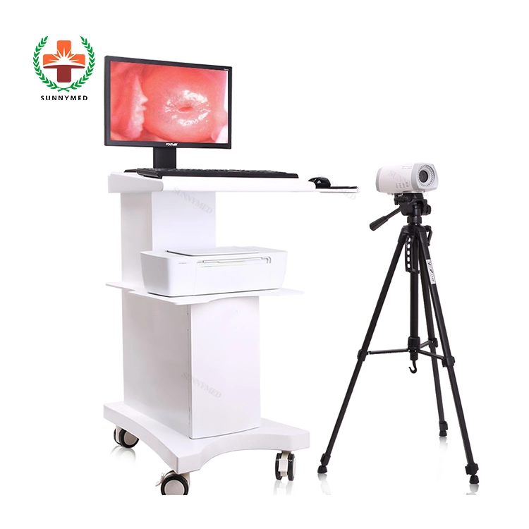 Medical Hospital Colposcope Digital Electronic Gynecological Colposcope