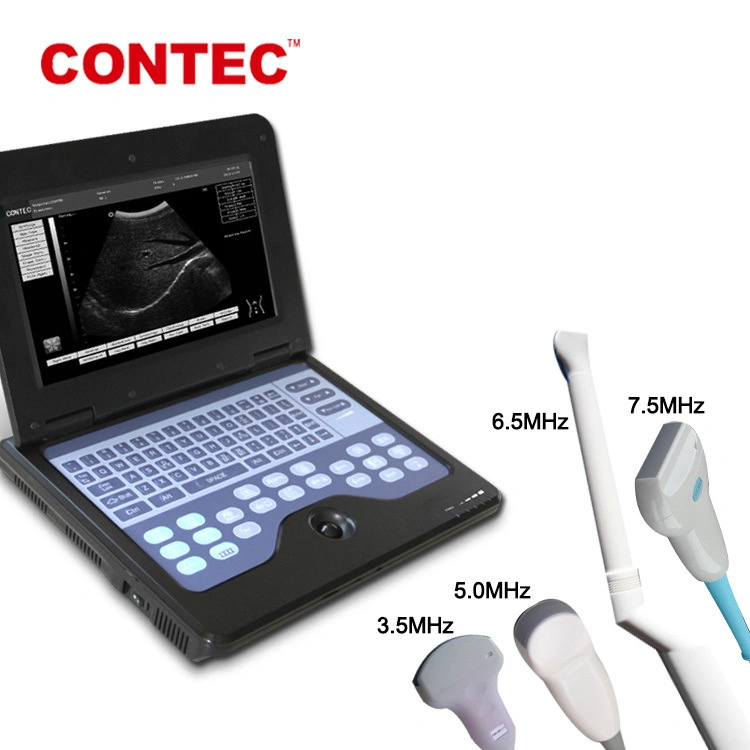 OLED Oxímetro adultos Salud cuántica Analyzer suministros médicos