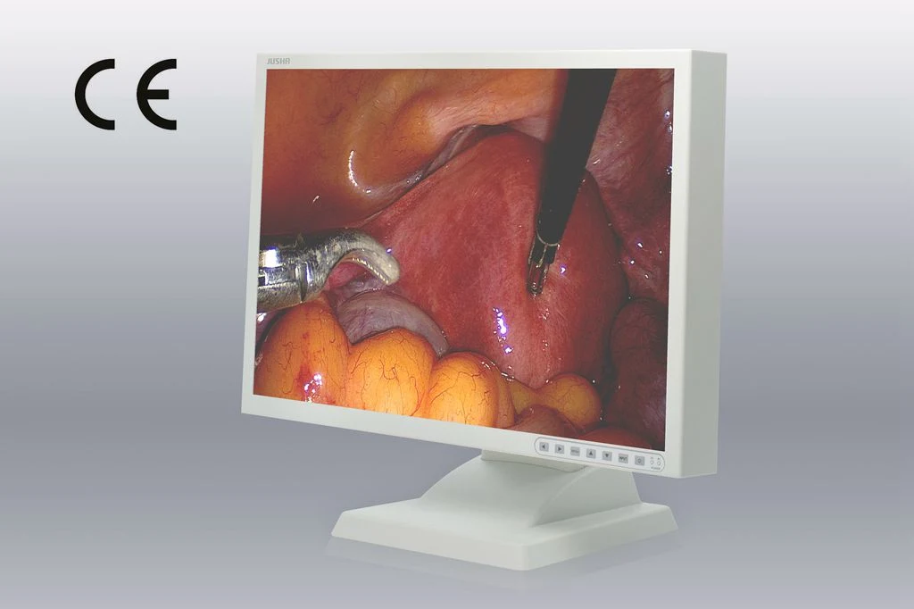 24 pouces écran LCD de 1920x1200 Endoscope moniteur, ce système d'image approuvée, endoscope