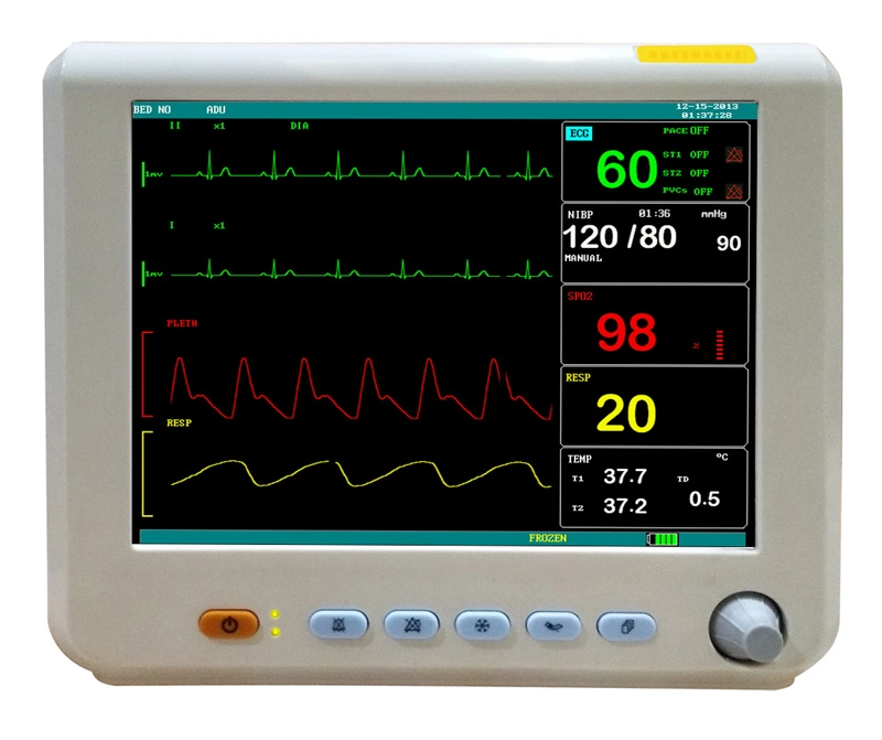 China ECG, SpO2, PR, PNI, Temp, Resp Hospital Medical UCI pequeño quirúrgico Monitor de paciente de 8 pulgadas