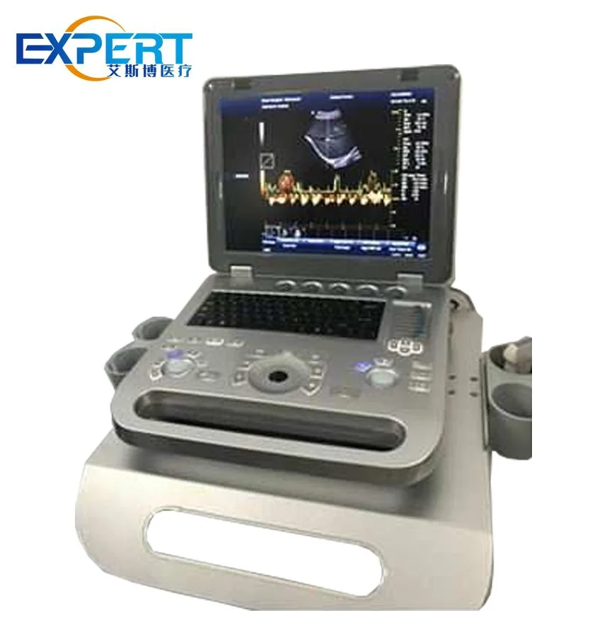 Medical Digital Echo Laptop 3D 4D Color Doppler Hospital Portable Ultrasound Scanner