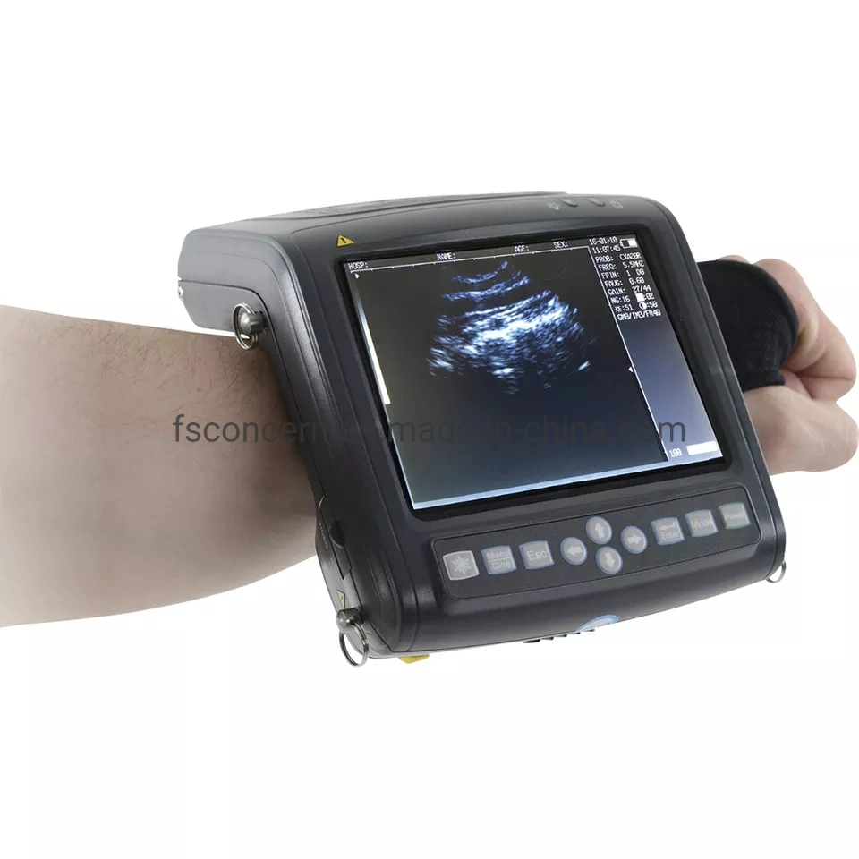 Medical Ccv-U5200 Rectal Probe Veterinary Palm Wrist Ultrasound Scanner Equipment