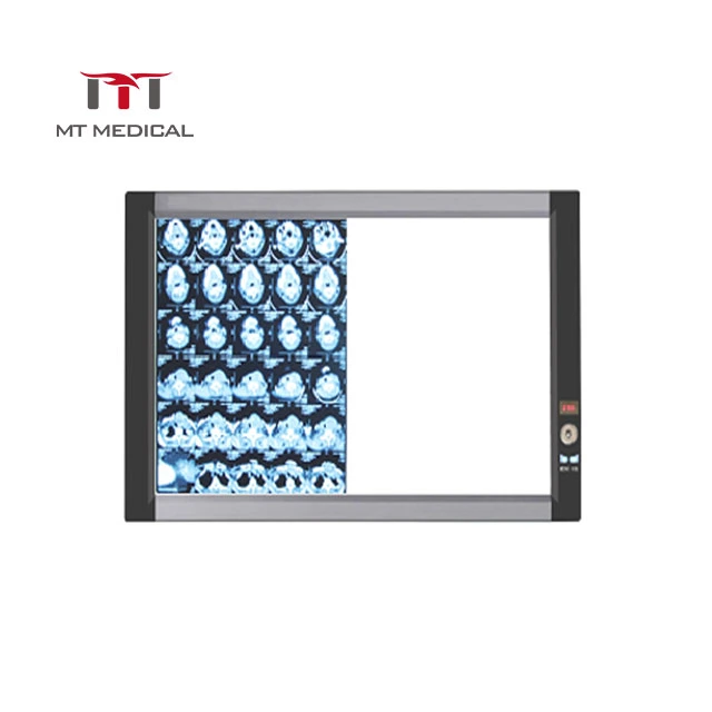 Light-Adjustable Medical X Ray Film Viewer LED Screen