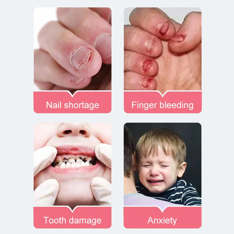 Stop Nail Bites beißen Bitter Nail Wasser Behandlung für Kinder