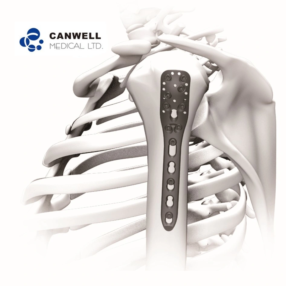 لوحة قفل من نوع Humerus Condylus، ولوحة كسر عنق هومروس، ولوحة قفل، وجريحي لولبي