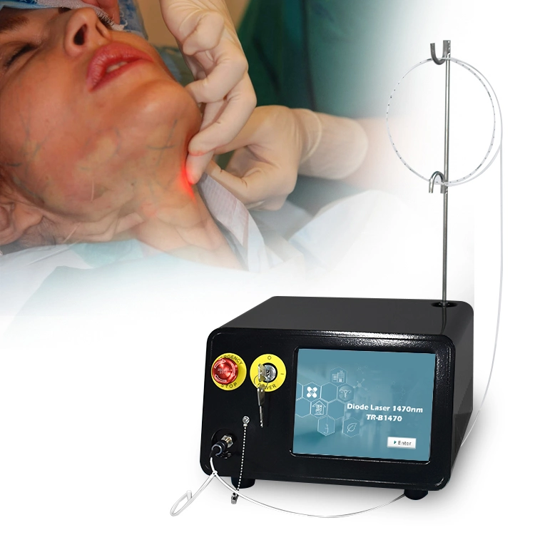 2024 Triangelaser poderoso 1470nm Diodo láser 12W Liposucción Cannula Belleza Equipo de Salón