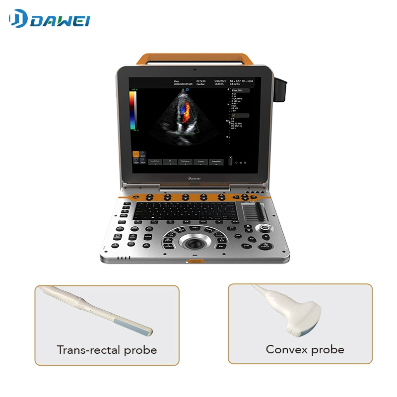 High quality/High cost performance 4D Color Doppler Dwp60 Ultrasound Diagnostic Scanner