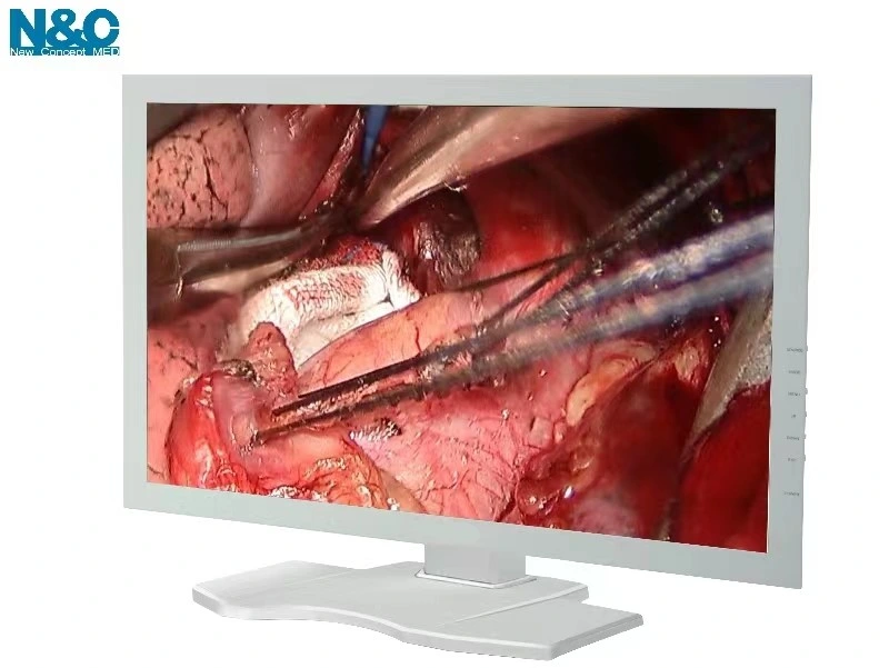 N&C Medical Endoscopic Equipment Endoscope HD Camera LED Surgical Endoscopy Monitor