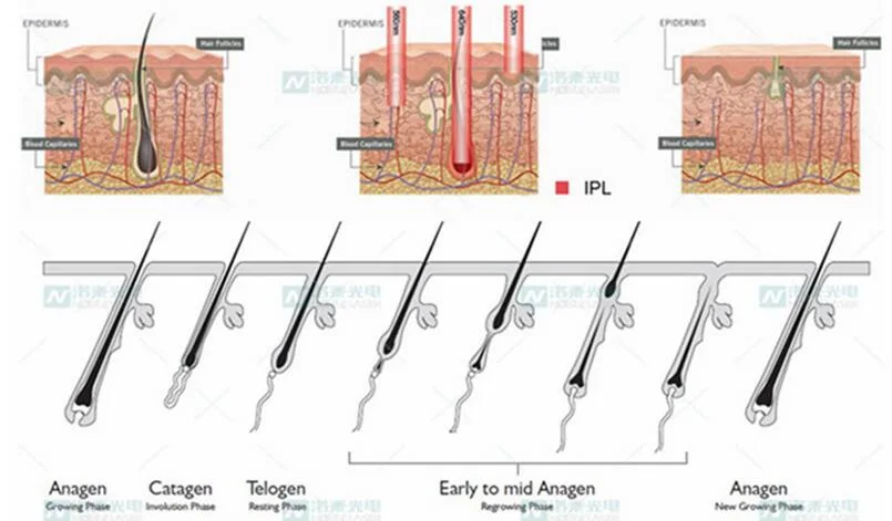 IPL Hair Removal Skin Rejuvenation Beauty Equipment