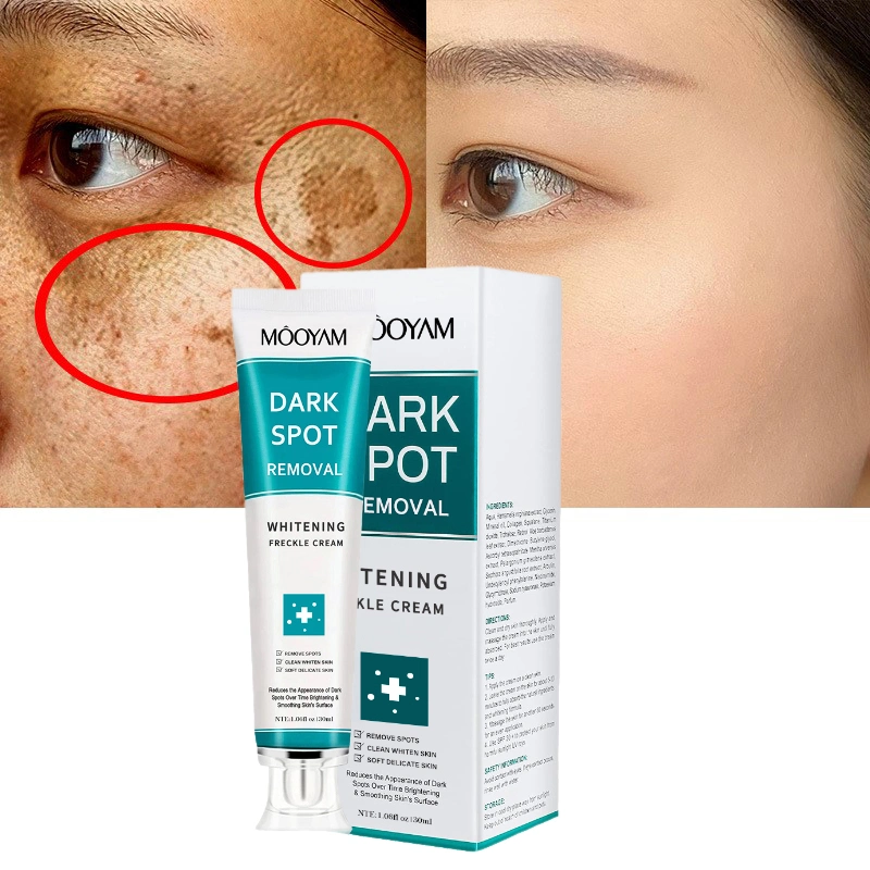 Wholesale Customize Own Brand Strong Whitening Freckle Cream Removal Melasma Dark Spot Melanin Remover Brighten Skin Face Cream