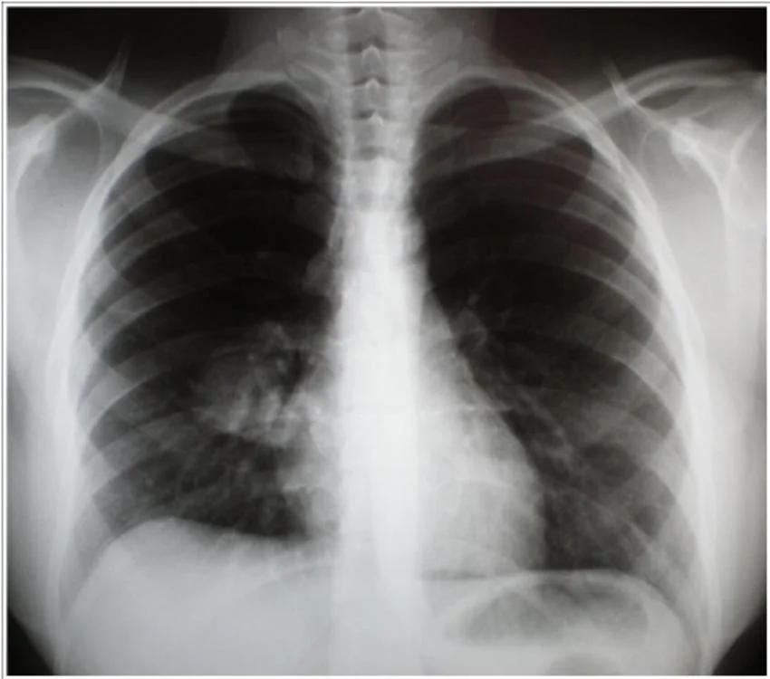 Utilisation de l'imprimante de l'hôpital médical sec radioactifs Blue Film d'impression thermique