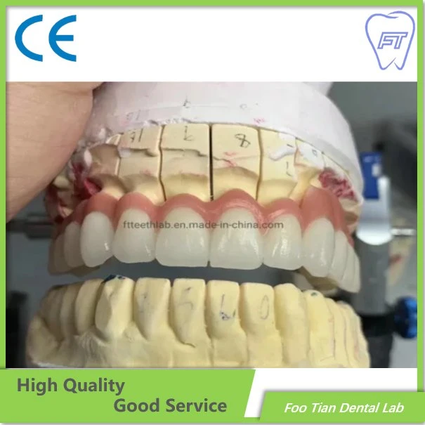 L'Orthodontie Traitement dentaire couronne en céramique de métal faites dans foo Tian Dental Lab à Shenzhen en Chine