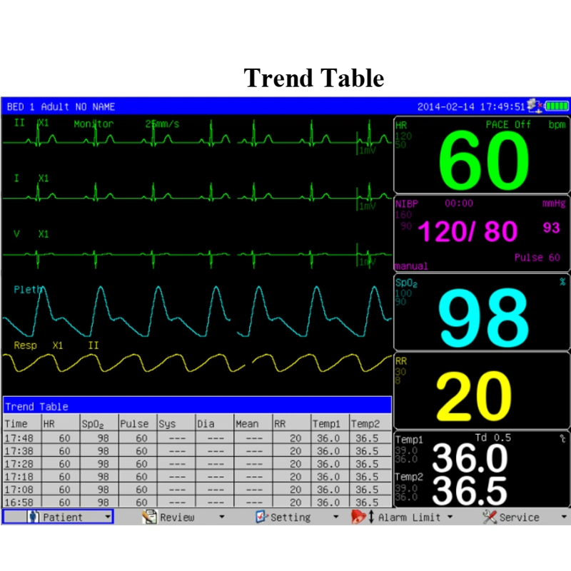 Medical Device Portable Multi Parameter Patient Monitor with Optional Printer