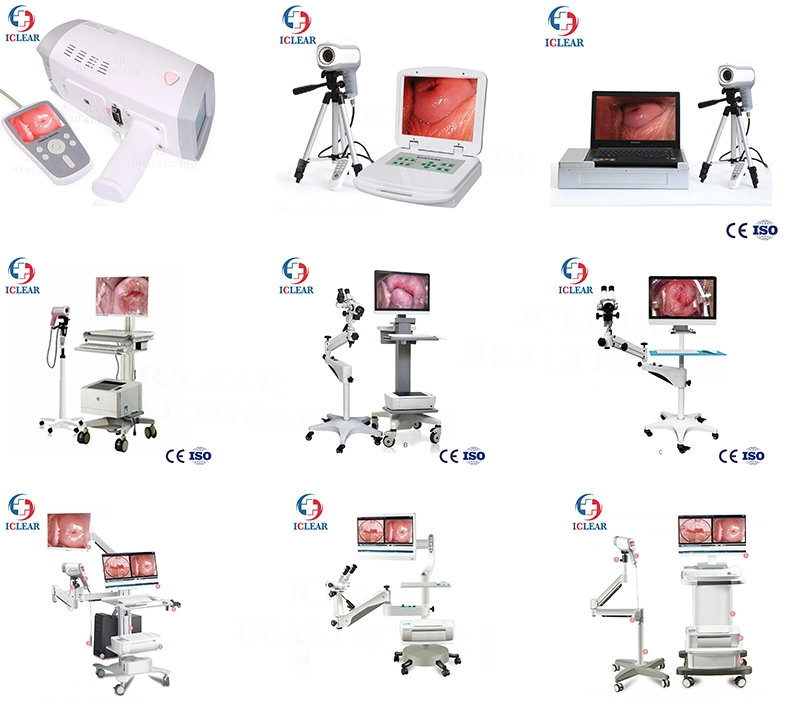 Sony CCD 2.1 Million Medical Digital HD Video Gynecology Colposcopy Equipment