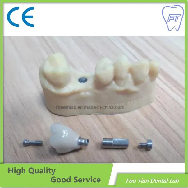 Hot Sale Dental Abutment Dental Implant Titanium Abutment