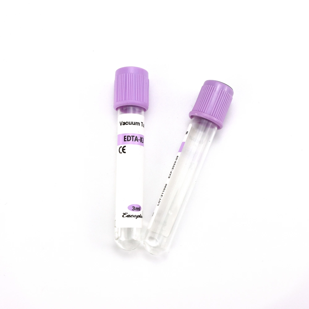 Siny Sodium Fluoride Tube Glucose Tube 2-10ml Sterile Single Use No Additive Blood Test Tube with Factory Price