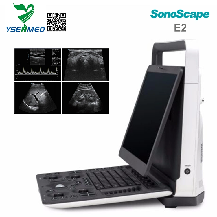 Sonoscape E2 Medizinische Geräte hochwertiger digitaler Laptop-Herzultraschall Scanner