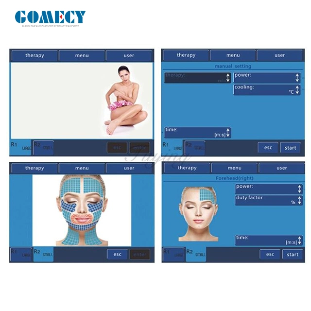 Ultrasonikator Body Contouring Anti-Falten-Maschine RF Fett lösen Messer Schönheit Ausrüstung