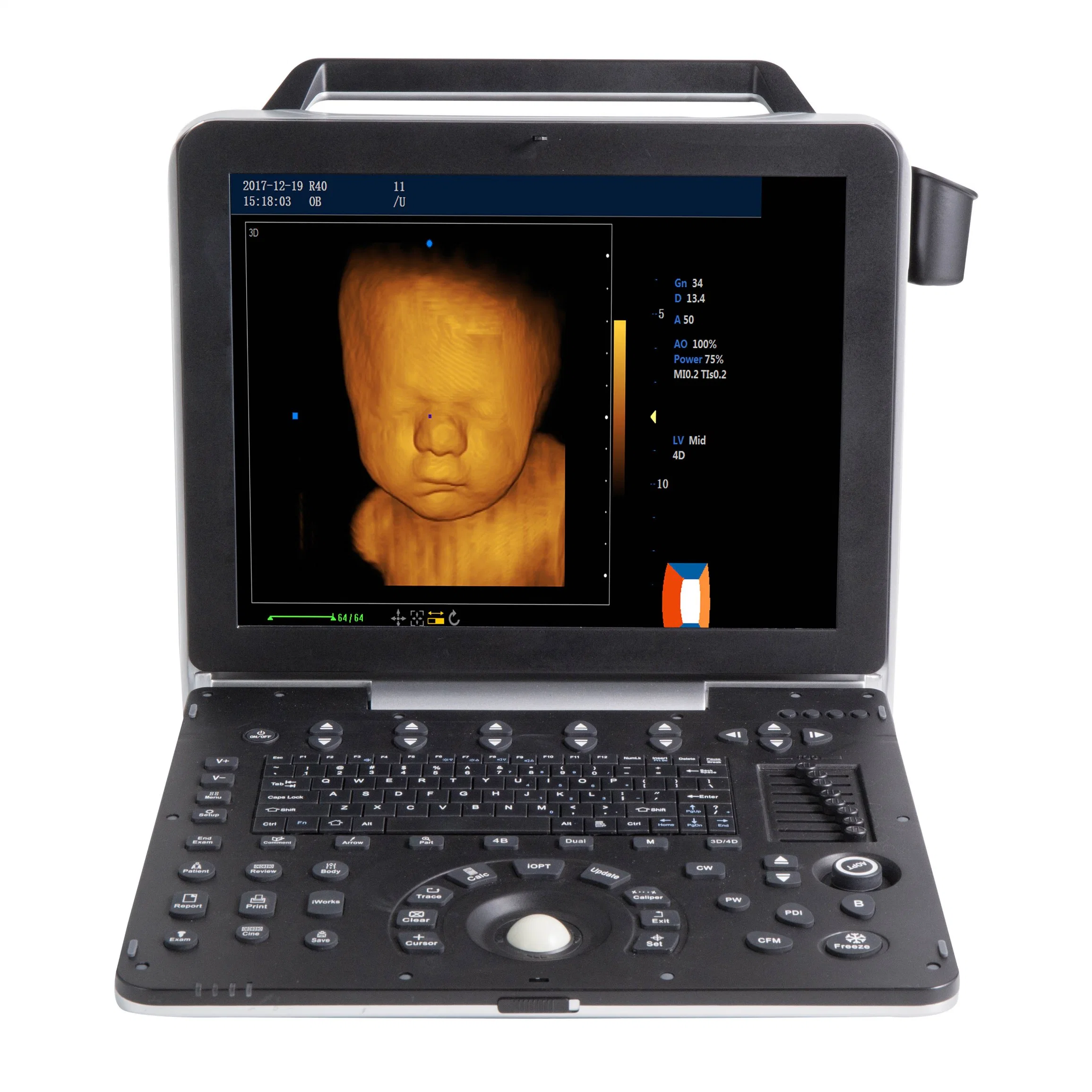 4D 5D Color Ultrasonic Diagnostic Apparatus, Portable Color Doppler Ultrasound Scanner Mslcu64