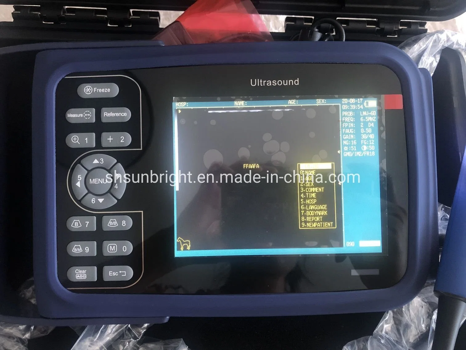 Handheld Vet Ultrasound Machine Echographe Portable Ultrasound Scanner