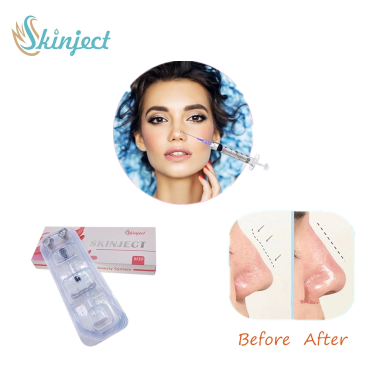 2021 Skinject Hot Sales 2ml Fine Derm Deep Face Filler Ha Injectable Hyaluronic Acid Dermal Filler