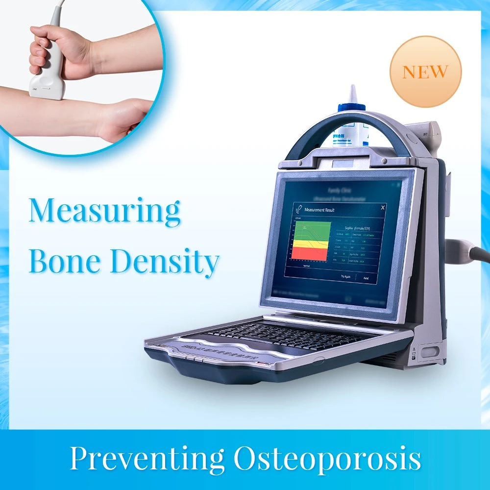 Automatic High Effective Portable Ultrasound Bone Densitoeterm