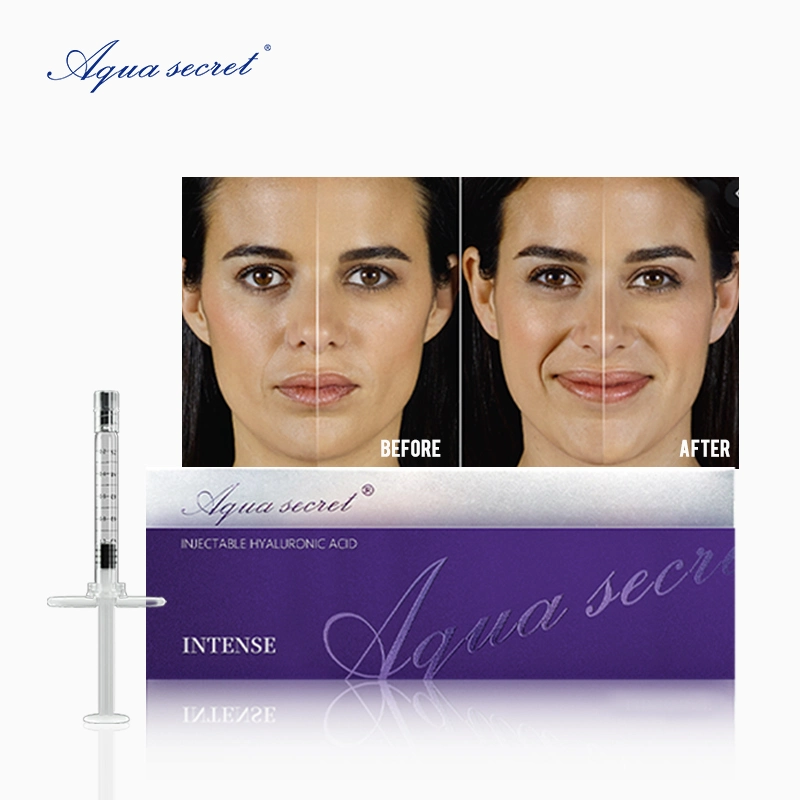 Aqua Secret Ha 1ml 2ml Dermal Filler Injection Cross Linked Hyaluronsäure für die Gesichtslippen