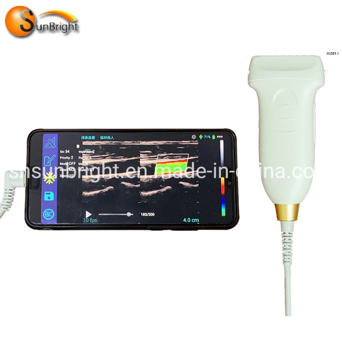 Affordable Color Doppler Software Pw Vascular Test Linear Probe