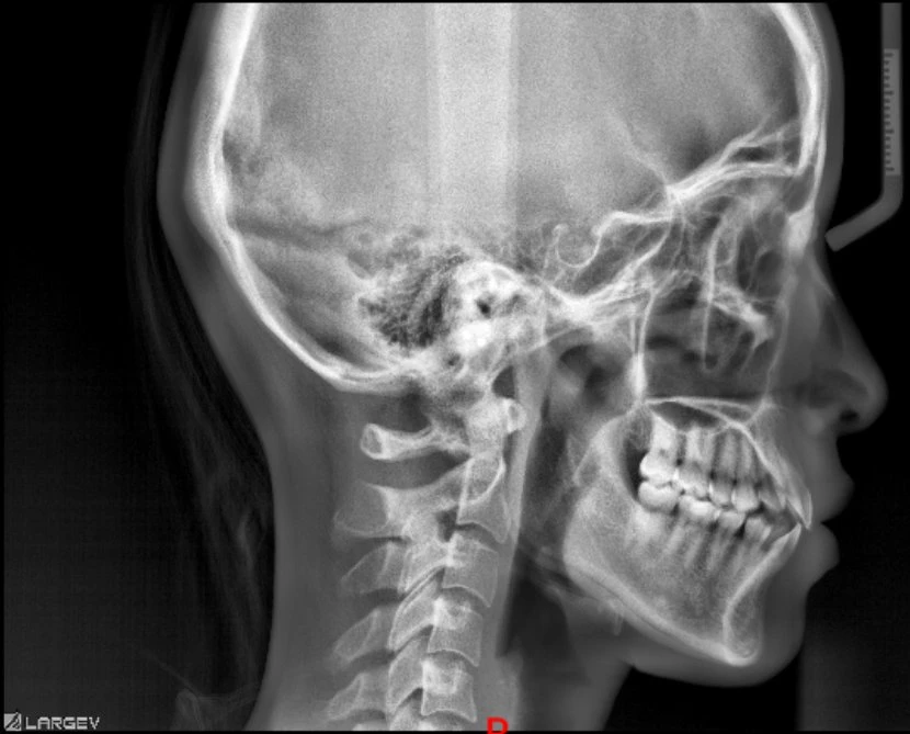 Smart 3D 2D Medical cefalométrico panorámico digital Dental Cbct Dispositivo de rayos X para diagnóstico con certificado CE Dental