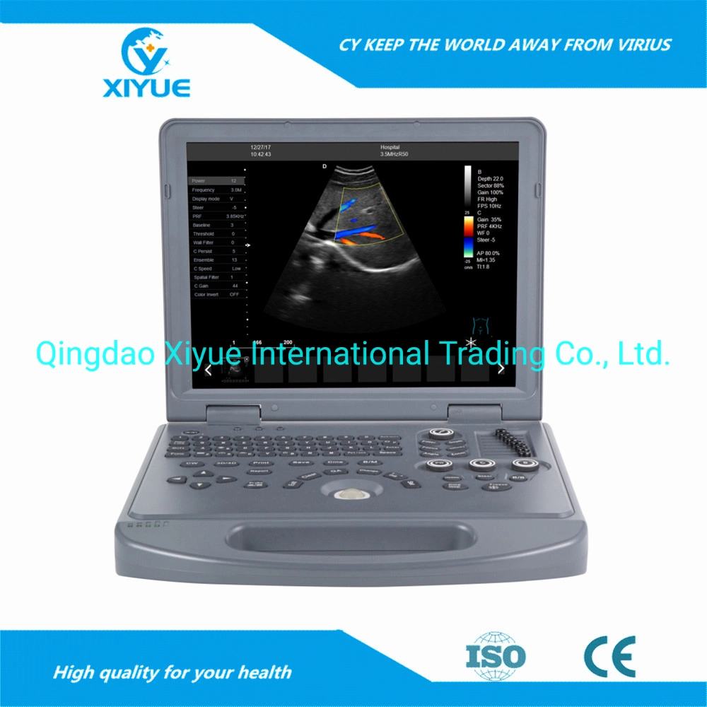 Full Digital Color Doppler Ultrasound Diagnosis System/ Laptop Portable Handheld Ultrasound