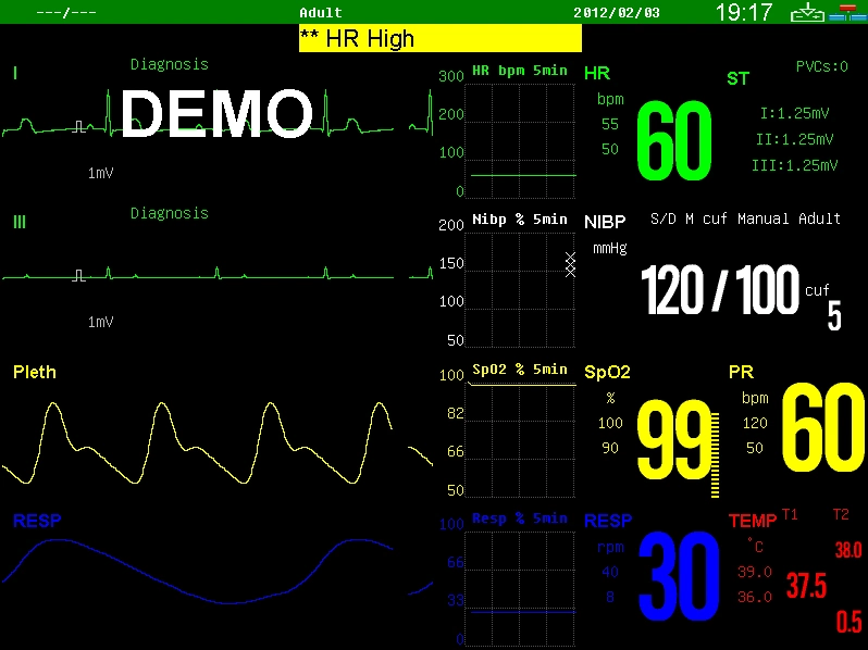 10.4inch Portable Patient Monitor with Suntech NIBP