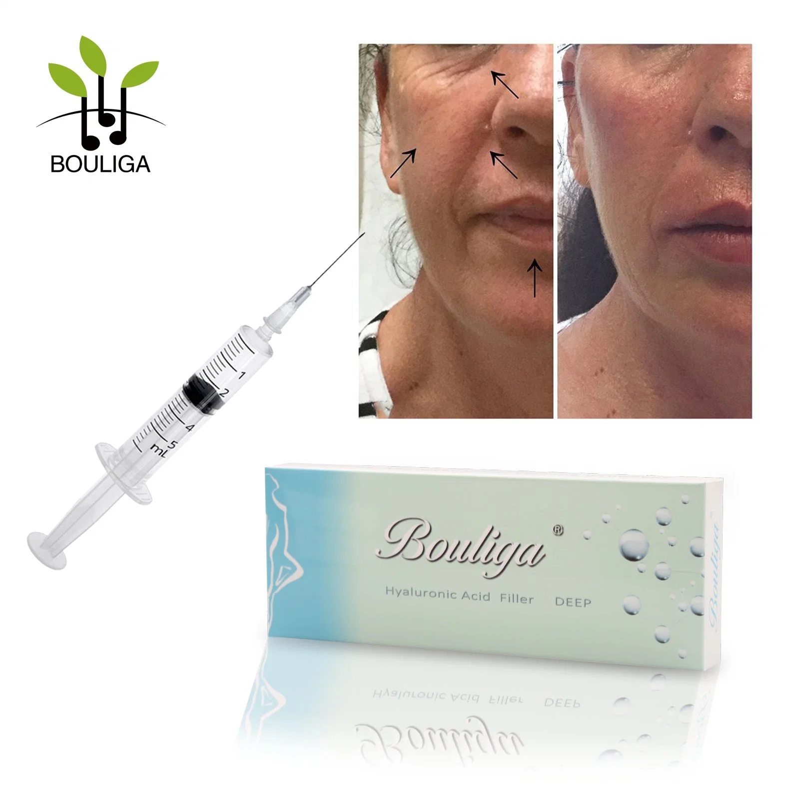 High quality/High cost performance Cross Linked Injectable Facial Hyaluronic Acid Dermal Filler for Face Care 1ml 2ml 10ml