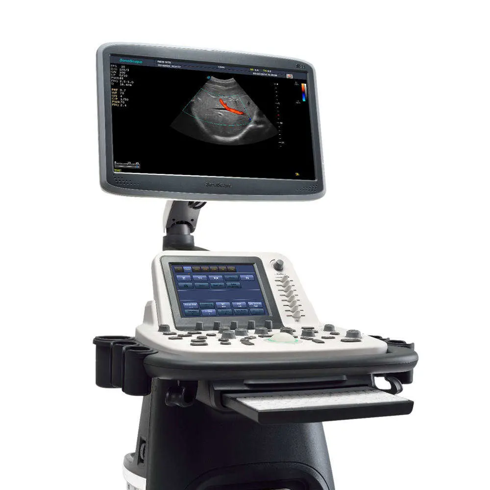 Ob/Gyn Sonoscape Trolley Type Ultrasonic 3D 4D Color Doppler Ultrasound Scanner