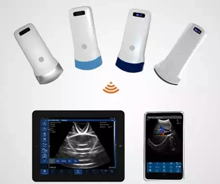 Ecografia portátil sem fios para diagnóstico médico Ecografia Wi-Fi Convexa Ultrasound Sonda