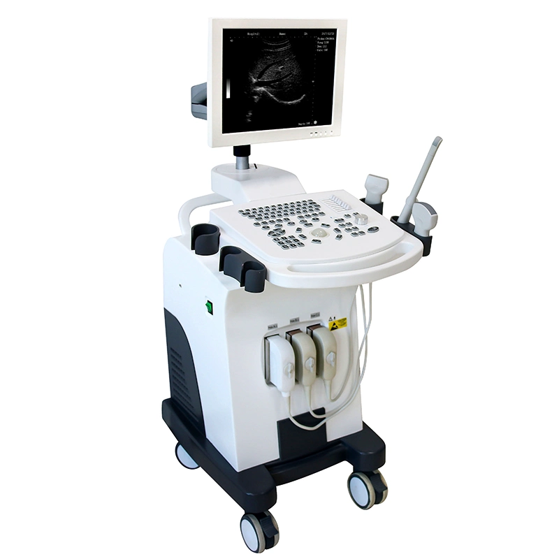 OEM Laptop Mecanmed Scanner Medical Equipment Hospital Portable Device Ultrasound with Trolley